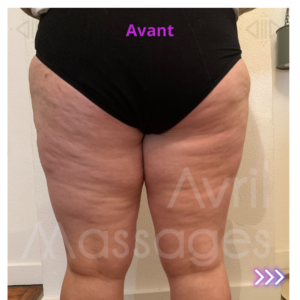 Drainage lymphatique & palper-rouler manuel