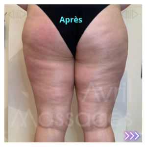 Drainage lymphatique & palper-rouler manuel