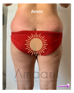 Cure minceur Amaaril Massages - Avant le Palper-rouler et drainage Lymphatique