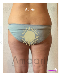 Cure minceur Amaaril Massages - Palper-rouler et drainage Lymphatique